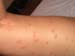 mosquitos4