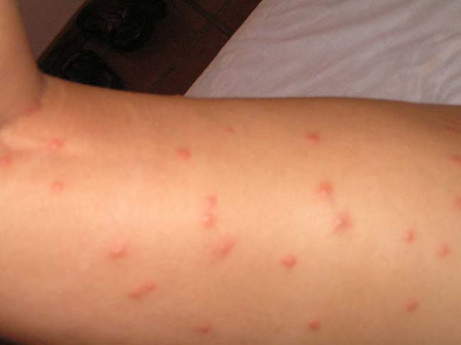 mosquitos4