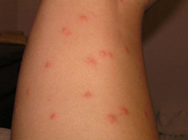 mosquitos5